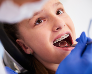 Cuidados Pós-tratamento Ortodôntico